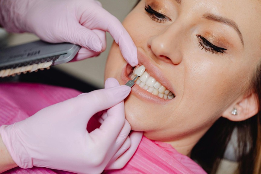 How Recent Technological Advances Are Shaping the Future of Cosmetic Veneers